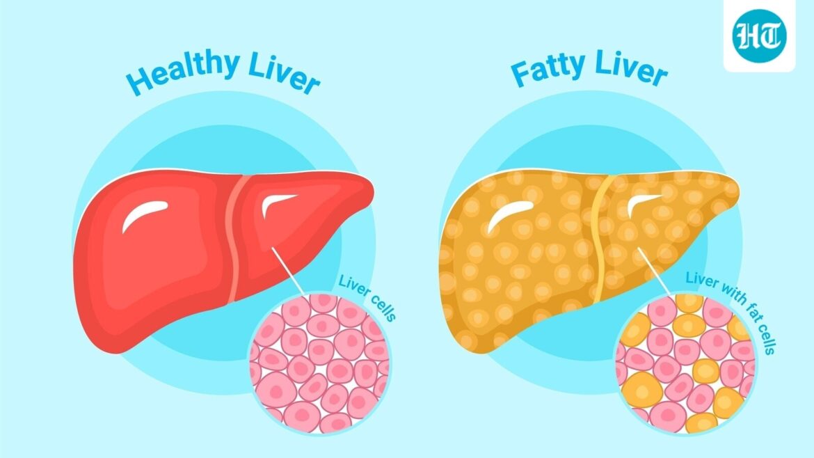 AIIMS-trained liver specialist shares 3 drinks for patients with fatty liver disease: 'Beetroot juice is packed with…'