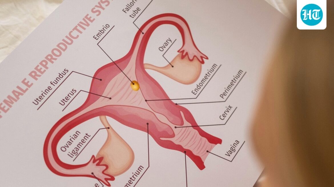 Gynaecologist debunks 4 myths about uterine fibroids that cause unnecessary alarm: ‘Most fibroids are not cancerous…’